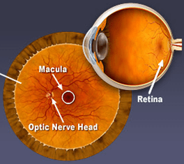 視網膜/黃斑圖片來源http://www.maculacenter.com/LightBox/glossaryImages/retina.jpg